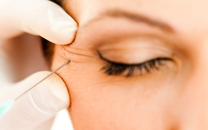 Những rủi ro và tác dụng phụ của Botox