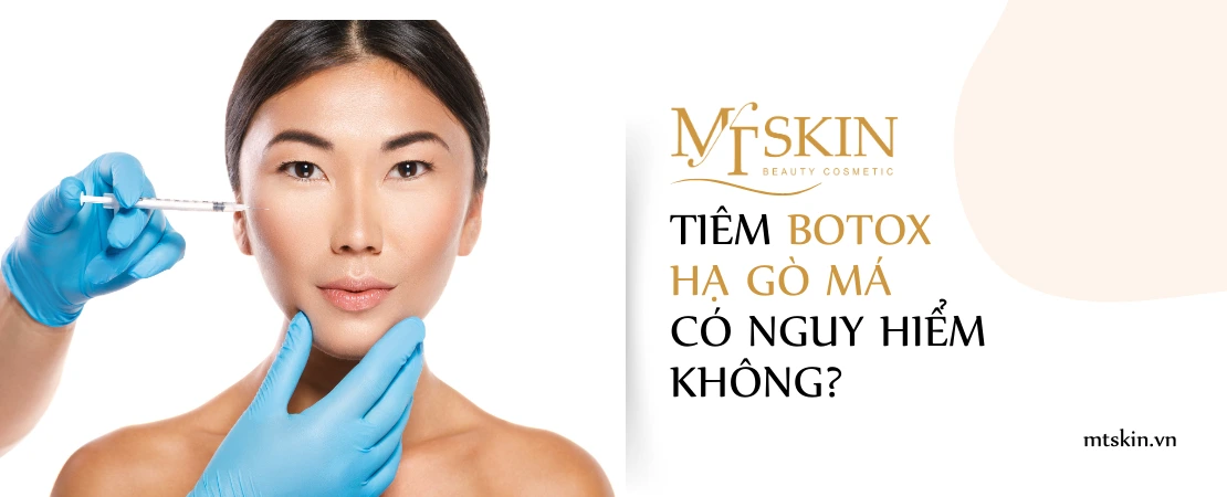 Tiêm Botox hạ gò má có nguy hiểm không?