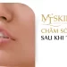 Cách chăm sóc môi sau khi tiêm filler đúng cách