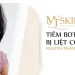Tiêm botox bị liệt cơ: Nguyên nhân & Cách xử lý