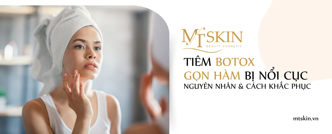 Cách phòng ngừa nổi cục sau khi tiêm botox