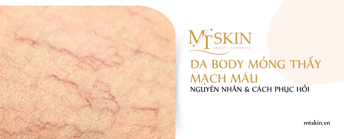 Da body mỏng thấy mạch máu: Nguyên nhân & Cách phục hồi